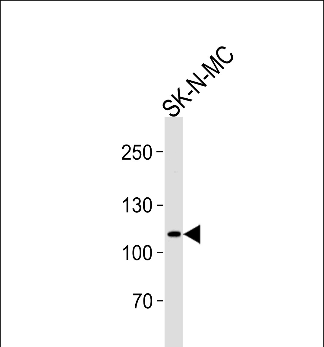 Rabbit Polyclonal Antibody to NOC3L (N-term)