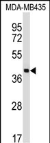 Rabbit Polyclonal Antibody to SFTPD