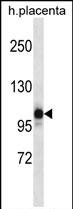 Rabbit Polyclonal Antibody to NLRP12 (N-term)