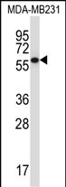 Rabbit Polyclonal Antibody to PPP2R5C