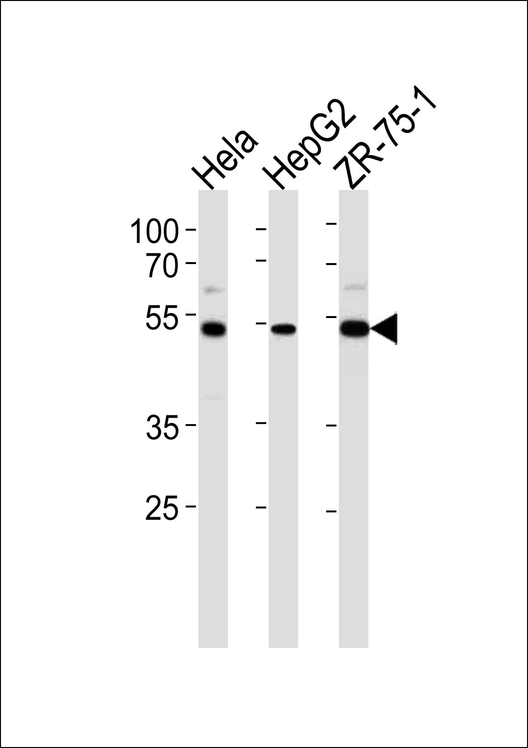 Rabbit Polyclonal Antibody to TERF2IP
