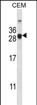 Rabbit Polyclonal Antibody to CIDEA