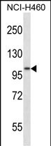 Rabbit Polyclonal Antibody to ADAM8 (N-term)