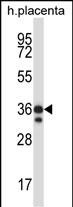 Rabbit Polyclonal Antibody to Mouse Mst4