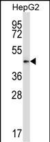 Rabbit Polyclonal Antibody to Mouse Pdk2 (N-term)