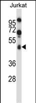 Rabbit Polyclonal Antibody to SPN/CD43