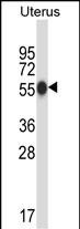 Rabbit Polyclonal Antibody to CPO (N-term)