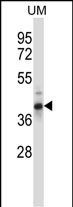 Rabbit Polyclonal Antibody to OAF (N-term)