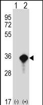 Rabbit Polyclonal Antibody to AES