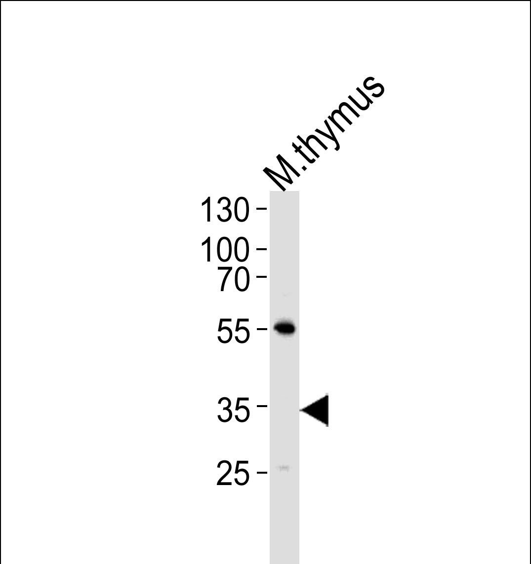 Rabbit Polyclonal Antibody to Mouse Lck (N-term)