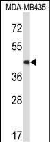 Rabbit Polyclonal Antibody to Mouse Map2k5