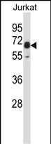 Rabbit Polyclonal Antibody to Mouse Pxk