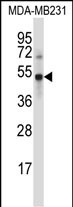 Rabbit Polyclonal Antibody to UBP46