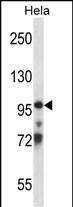 Rabbit Polyclonal Antibody to TCEB3