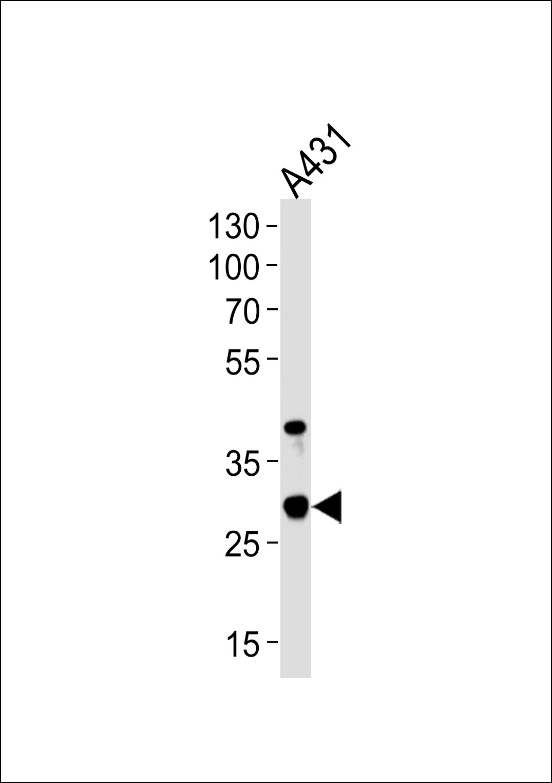 Rabbit Polyclonal Antibody to JAM2 (N-term)