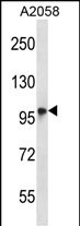 Rabbit Polyclonal Antibody to TMC6 (N-term)