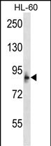 Rabbit Polyclonal Antibody to MCPH1 (N-term)