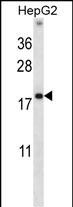 Rabbit Polyclonal Antibody to HMGN1 (N-term)