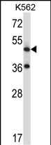 Rabbit Polyclonal Antibody to TACR3