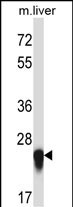 Rabbit Polyclonal Antibody to IL27