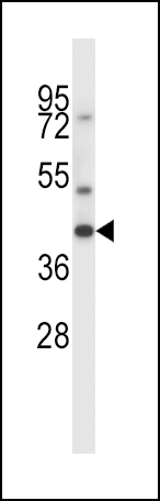 Rabbit Polyclonal Antibody to MAS1