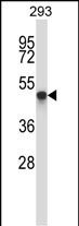 Rabbit Polyclonal Antibody to TOM1L1