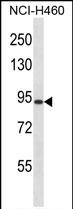 Rabbit Polyclonal Antibody to RGS9 (N-term)