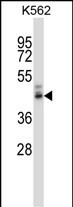 Rabbit Polyclonal Antibody to PPYR1 (N-term)