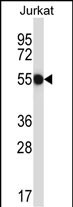 Rabbit Polyclonal Antibody to CNOT2