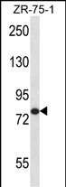 Rabbit Polyclonal Antibody to AGGF1 (N-term)