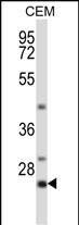 Rabbit Polyclonal Antibody to LIME1