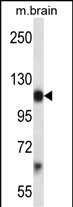Rabbit Polyclonal Antibody to Mouse Pdgfra