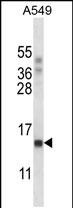 Rabbit Polyclonal Antibody to POLR2J
