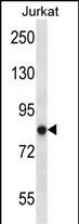 Rabbit Polyclonal Antibody to Mouse Prkca (N-term)