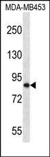 Rabbit Polyclonal Antibody to OTU7B