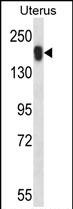 Rabbit Polyclonal Antibody to USP43