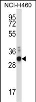 Rabbit Polyclonal Antibody to ZFPL1