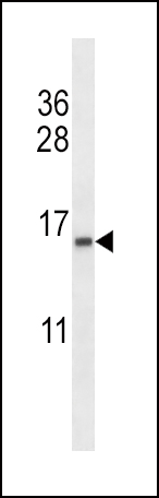 Rabbit Polyclonal Antibody to TCEB2