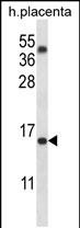 Rabbit Polyclonal Antibody to TM4SF18