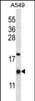 Rabbit Polyclonal Antibody to HIGD2A (N-term)