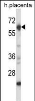 Rabbit Polyclonal Antibody to Mouse Nrbp2