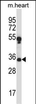 Rabbit Polyclonal Antibody to MARCH1