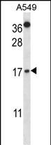 Rabbit Polyclonal Antibody to CSTA