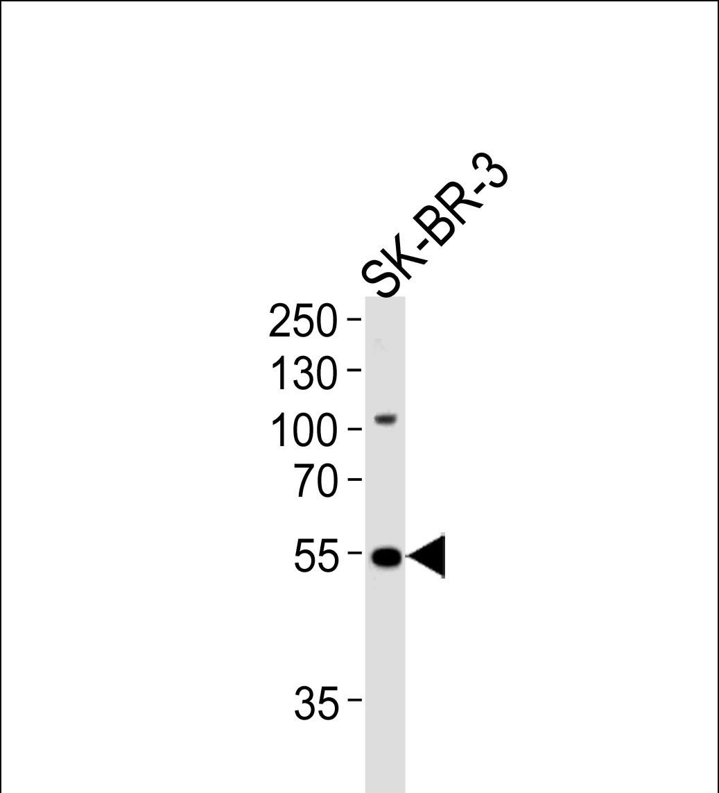 Rabbit Polyclonal Antibody to SMARCE1