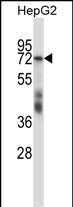 Rabbit Polyclonal Antibody to SF1