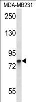 Rabbit Polyclonal Antibody to PADI2