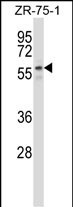 Rabbit Polyclonal Antibody to PUF60 (N-term)