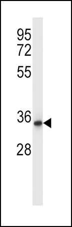 Rabbit Polyclonal Antibody to QPRT