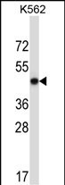 Rabbit Polyclonal Antibody to METAP2 (N-term)