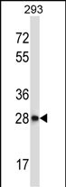 Rabbit Polyclonal Antibody to CTDSP2 (N-term)